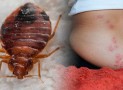Traitement des punaises de lit : est-il possible d&rsquo;utiliser des méthodes naturelles ?